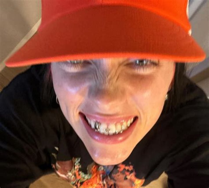 Billie Eilish Missing A Tooth