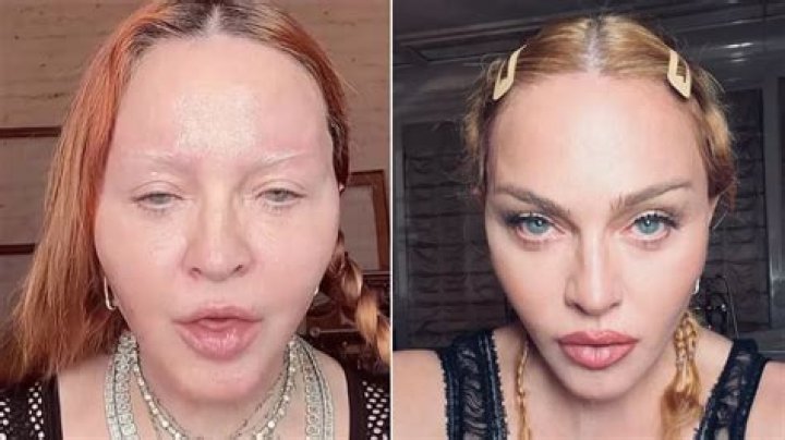 bitchy | madonna puffy face
