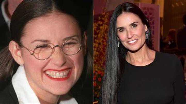 Demi Moore: her stress-induced tooth fall, her marriages, her divorces, her relationships, and more! Read it here! Demi Moore: her stress-induced tooth fall, her marriages, her divorces, her relationships, and more! Read it here!