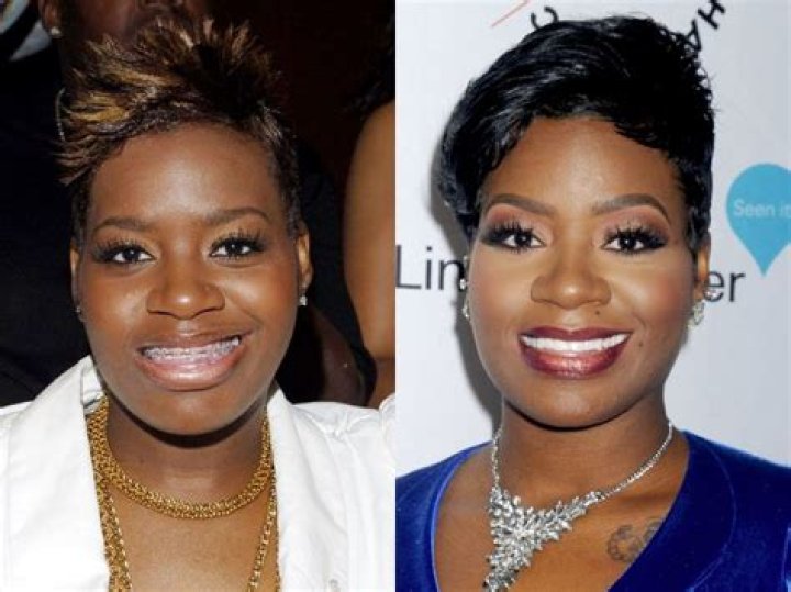 Fantasia Barrino Teeth