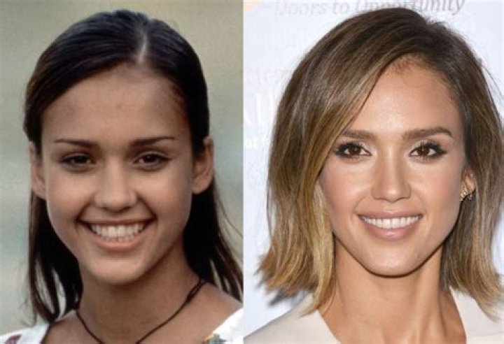 Jessica Alba Plastic Surgery