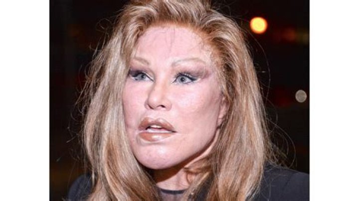 Jocelyn Wildenstein Bio (Wiki) 